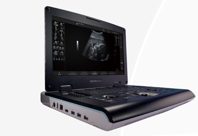 超音波診断装置(エコー)